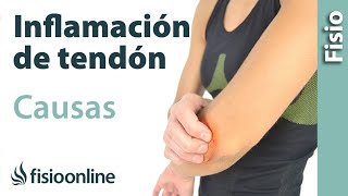 ¿Qué es la tendinitis o inflamación de tendón y cuáles son sus causas [upl. by Htbazile]