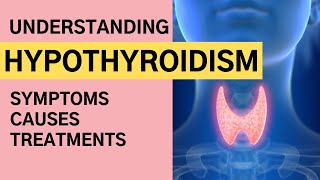 Understanding Hypothyroidism  Hypothyroidism Causes Symptoms Diagnosis and Treatment [upl. by Schurman]