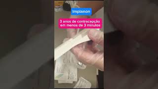 Implante contraceptivo [upl. by Samanthia365]