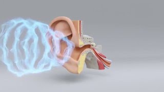 Explore the Science of Hearing Loss  MiracleEar Hearing Center [upl. by Eiuqnom]