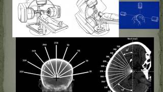 SRS Lecture 2 Stereotactic Imng w audio [upl. by Nnairrek]