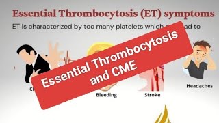 CME and Adult Essential Thrombocytosis [upl. by Romanas906]