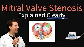 Mitral Valve Stenosis Explained Clearly  Pathophysiology Symptoms Treatment [upl. by Adabel]