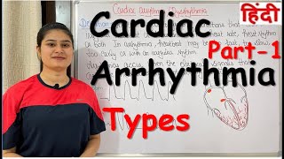 Cardiac Arrhythmia  Part1  Types of Cardiac Arrhythmia  RajNEET Medical Education [upl. by Ahseen]