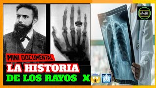 🩻¿Quien inventó los Rayos X🤔🩻La Historia de los Rayos X🩻💀La Primera Radiografía😱🩻⚡ [upl. by Yelsnia932]