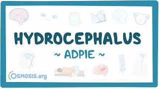 Hydrocephalus Nursing Process [upl. by Aihn]