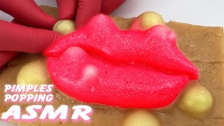 Unwind with a Pimple Popping Livestream on Realistic Silicone Models  Stress Relief Therapy [upl. by Stutman640]