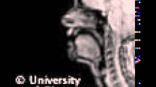 Voiced uvular plosive MRI [upl. by Yrogiarc]