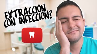 ¿EXTRACCÍON DENTAL CON INFECCÍON ¡QUE DEBES HACER 17 [upl. by Aikahs]