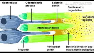 Structure of dentin  odontoblast  odontoblast processes  HD images labelled  important for viva [upl. by Ettennat652]