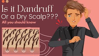 Is It Dandruff Or A Dry Scalp Heres What You Need To Know [upl. by Eded]