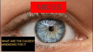 Miosis  Causes Mnemonic made easy [upl. by Tihor817]