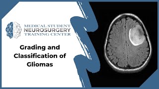 Grading and Classification of Gliomas [upl. by Luttrell]