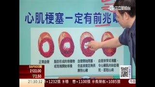 0525 心臟痛會痛到手指頭嗎？第11集2│88健康有方│三立財經台CH88│主持人 張雅芳 [upl. by Annabel]