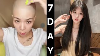 Only 7 Days Hair Growth Challenge  Stop Hair Fall  Make Magic Hair Oil At Home BENATURALRekha [upl. by Maffei423]