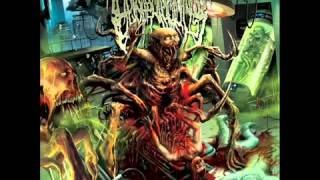 Epicardiectomy  Putreseminal Morphodysplastic Virulency 2014 full album [upl. by Ardnaxela486]