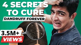 4 SECRET Tips To Remove Dandruff Forever  BeerBiceps Health [upl. by Ellehsar]