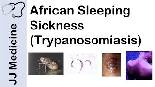 African Sleeping Sickness Trypanosomiasis  Causes Symptoms and Treatment [upl. by Terryl65]