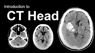 Introduction to CT Head Approach and Principles [upl. by Sheelah]