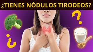 ¿TIENES NÓDULOS TIROIDEOS síntomas diagnóstico y tratamiento [upl. by Manno]