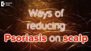 What helps psoriasis on scalp  Dr Rasya Dixit [upl. by Radferd]