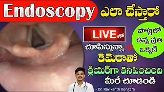 What is Endoscopy  Uses of Endoscopy  Gas Trouble  GERD  Heart Burn  Dr Ravikanth Kongara [upl. by Hepsoj788]