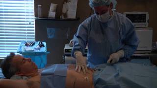 Vaser Liposuction  SmartLipo [upl. by Nalloh]