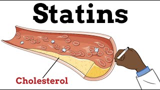 High Cholesterol and Statins [upl. by Suzie607]