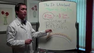 Dr Whiteboard Treating Dry Eye With Restasis [upl. by Ecirb]