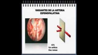 Variantes anatómicas de la vascularización nasal  Nasal arteries anatomic variants [upl. by Mcarthur436]