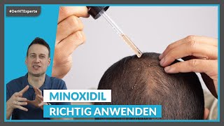 Minoxidil bei Haarausfall Die RICHTIGE Dosierung Nebenwirkungen amp Kosten [upl. by Witkin]