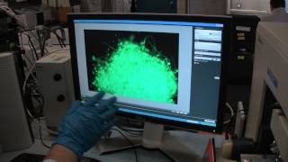 Borrelia Burgdorferi Biofilm  Live Microscopy Video [upl. by Oskar679]