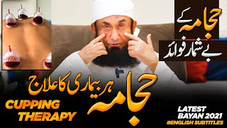 Cupping  Cure To Every Disease  Benefits of Cupping Therapy  Molana Tariq Jamil 3 March 2021 [upl. by Gudren590]