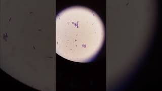 B cereus microbiology bacteria bacillus diarrhoea science [upl. by Eiffub]