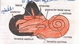 Menieres Disease Dr Foheid Alsobei [upl. by Eelorac]