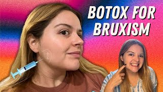 I Got Masseter Botox for Bruxism My Experience Cost Results and Side Effects  Under Eye Botox [upl. by Lahsiv]