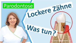 Parodontitis Was kann man tun wenn Zähne schon locker sind Zahnarztpraxis N Redjai Großostheim [upl. by Siraval]