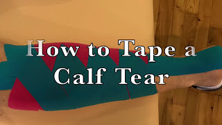 How to Apply Kinesiology Tape for Tape Calf Tear Gastrocnemius Taping [upl. by Cristine]