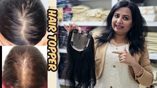 Hair toppers എങ്ങനെ ആർക്കും മനസ്സിലാവാത്ത രീതിയിൽ ഭംഗിയിൽ നമ്മുടെ തലയിൽ സെറ്റ് ചെയ്യാം ❤️MUST WATCH [upl. by Anaik]