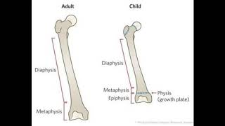 Benign bone tumourosteoma osteoid osteomaosteoblastoma [upl. by Adekahs859]