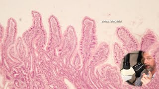 Microscopic anatomy of the small intestine [upl. by Eelloh]