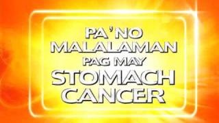 PINOY MD Stomach Cancer [upl. by Cardwell992]