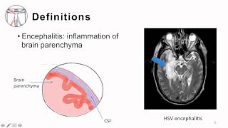 2 Bacterial Meningitis Pathogenesis and Clinical Manifestion [upl. by Sadinoel]