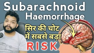 Subarachnoid Haemorrhage Kya Hota Hai  Subarachnoid haemorrhage Cause Symptoms amp Treatment Hindi [upl. by Ayenat]