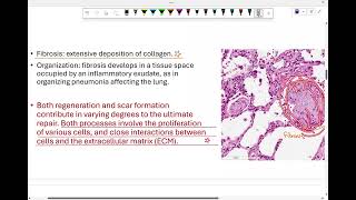 Intro to pathology tissue repair 1 [upl. by Nettie]