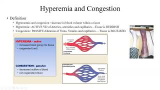 Pathology Made Easy 4 Hemodynamic Disorders [upl. by Ronaele310]