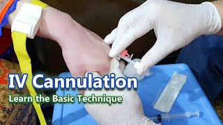 IV Cannulation  Learn the Basic Technique  IV Cannula [upl. by Ssitruc]