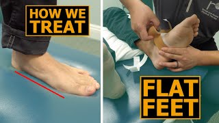 How We Treat Flat Feet  Collapsed Arches  Physical Therapy [upl. by Nunci853]