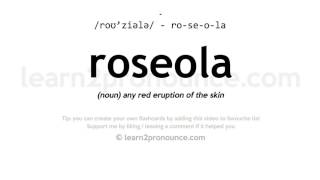 Pronunciation of Roseola  Definition of Roseola [upl. by Maurene]