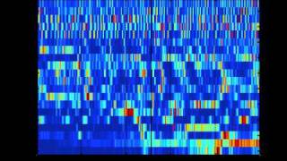 SCHIZOPHRENIA AS SOUND listening to the dynamic brain [upl. by Nickola]